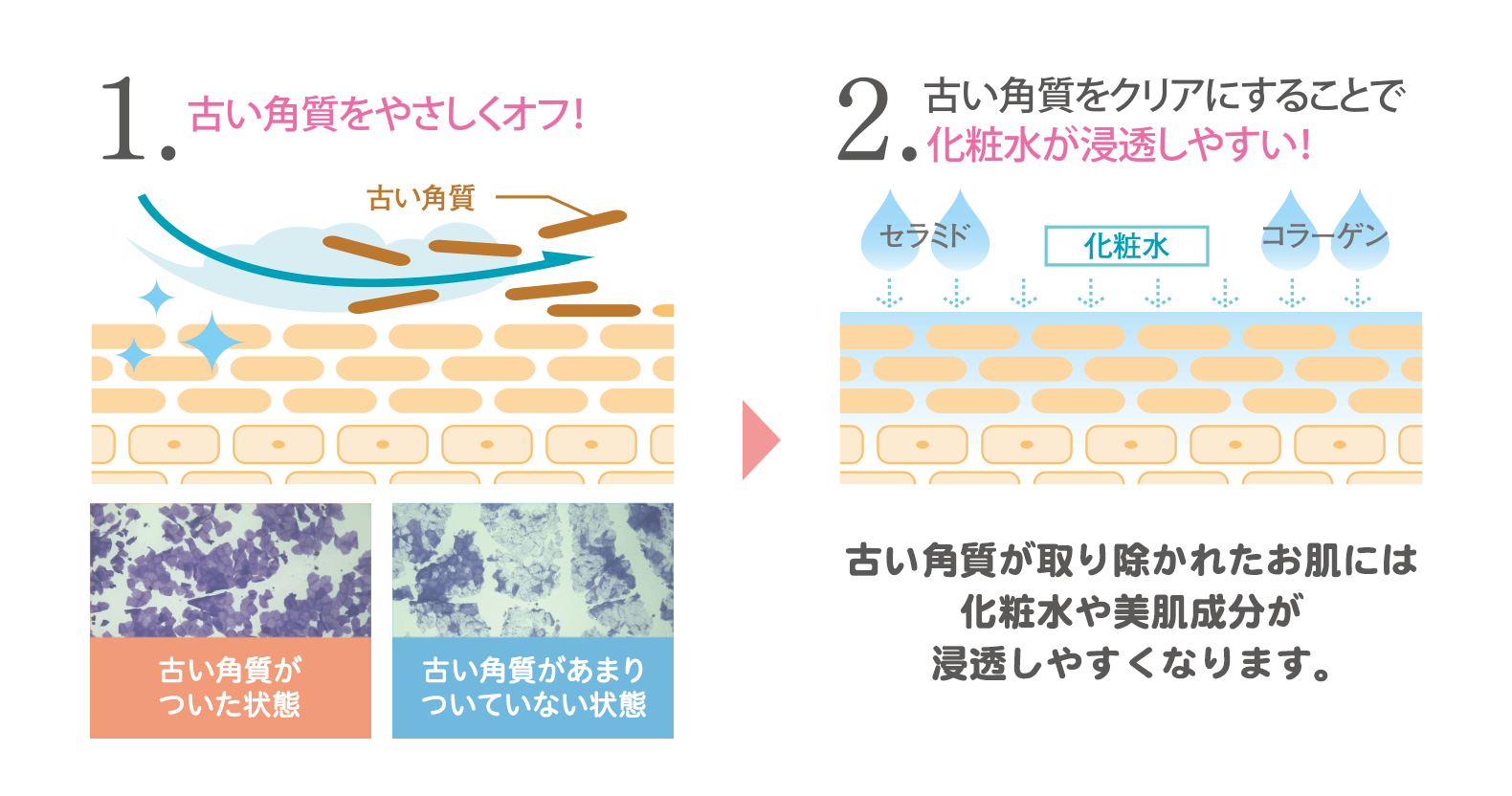 肌のざらつきのしくみ