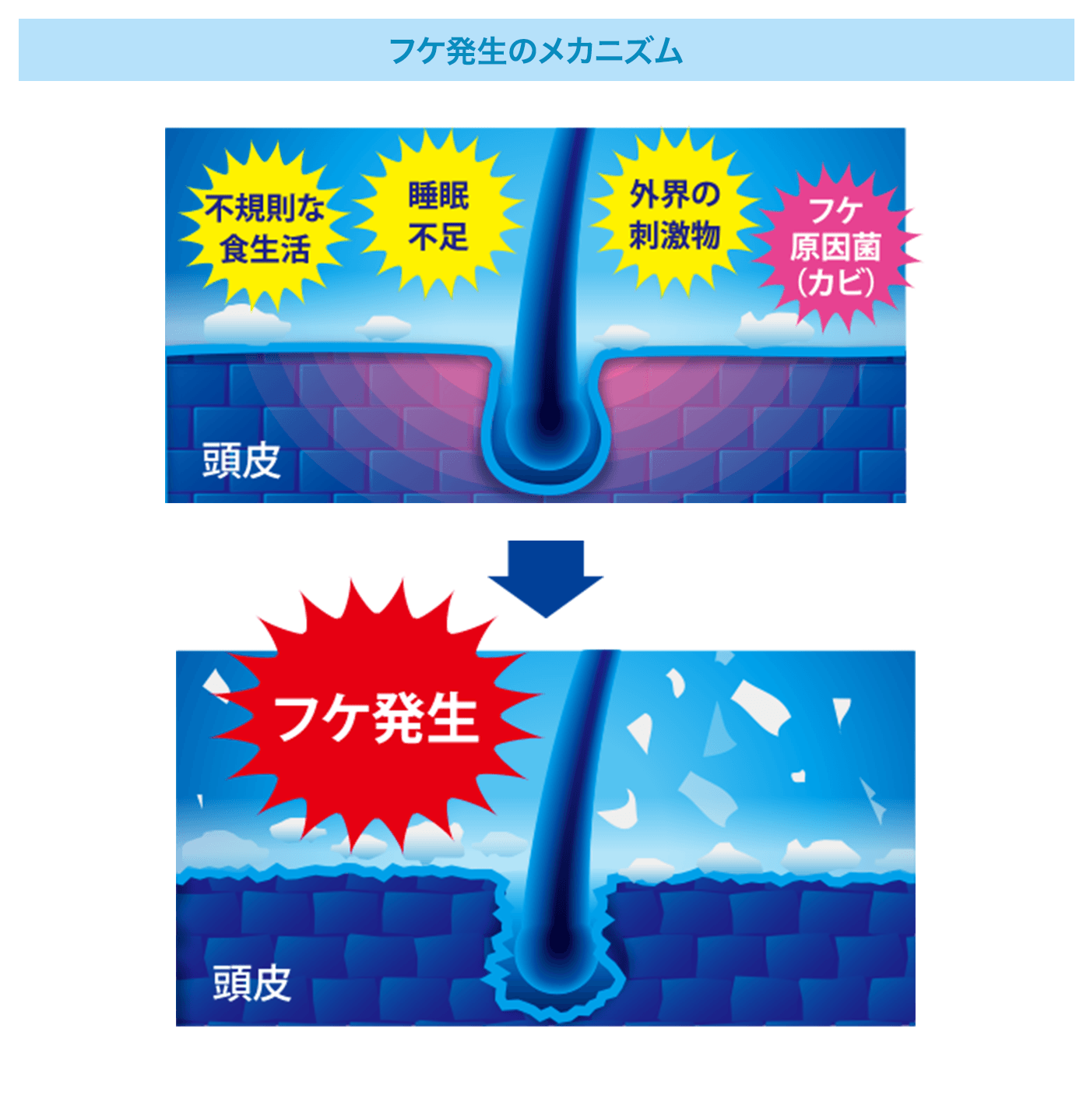 フケ発生のメカニズム