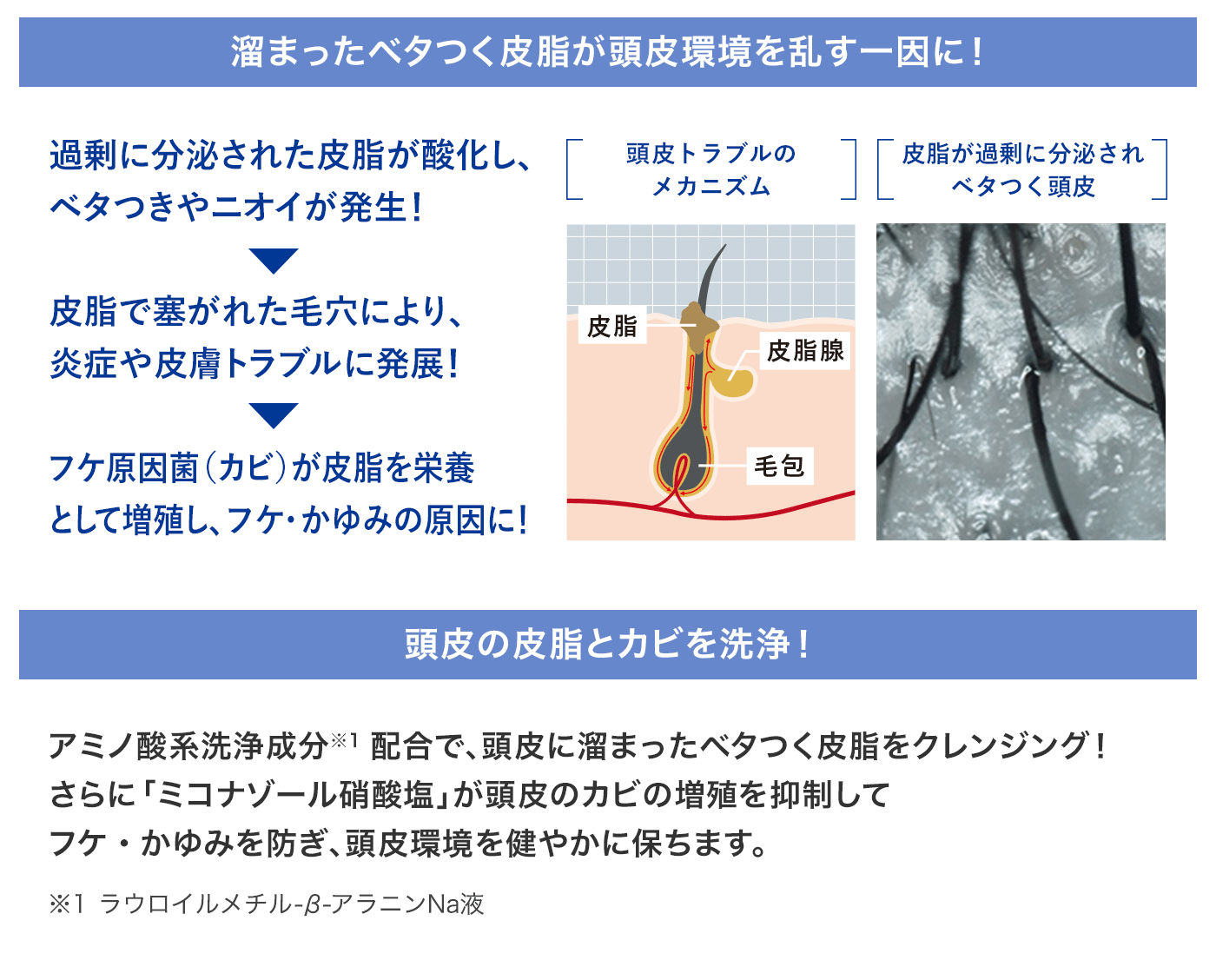 頭皮のカビと皮脂を洗浄！