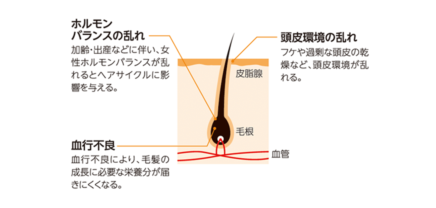 女性の抜毛・薄毛の原因として考えられるもの