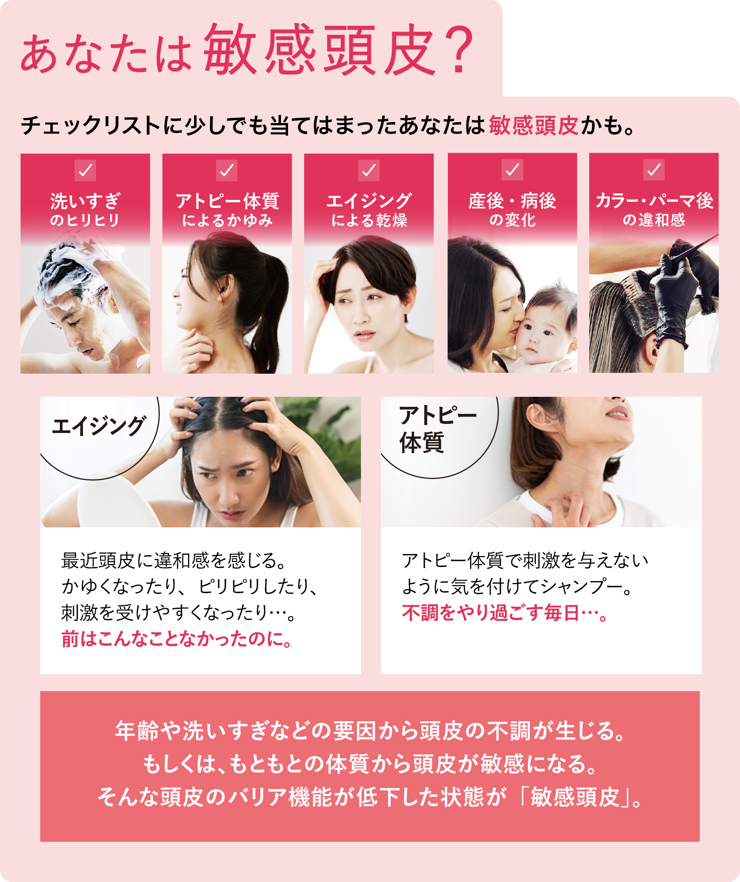 あなたは敏感頭皮?年齢や洗いすぎなどの要因から頭皮の不調が生じる。もしくは、もともとの体質から頭皮が敏感になる。そんな頭皮のバリア機能が低下した状態が「敏感頭皮」。
