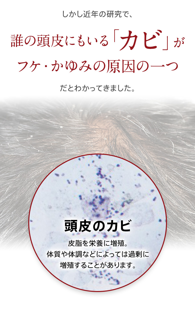 しかし近年の研究で、誰の頭皮にもいる「カビ」がフケ・かゆみの原因の一つだとわかってきました。