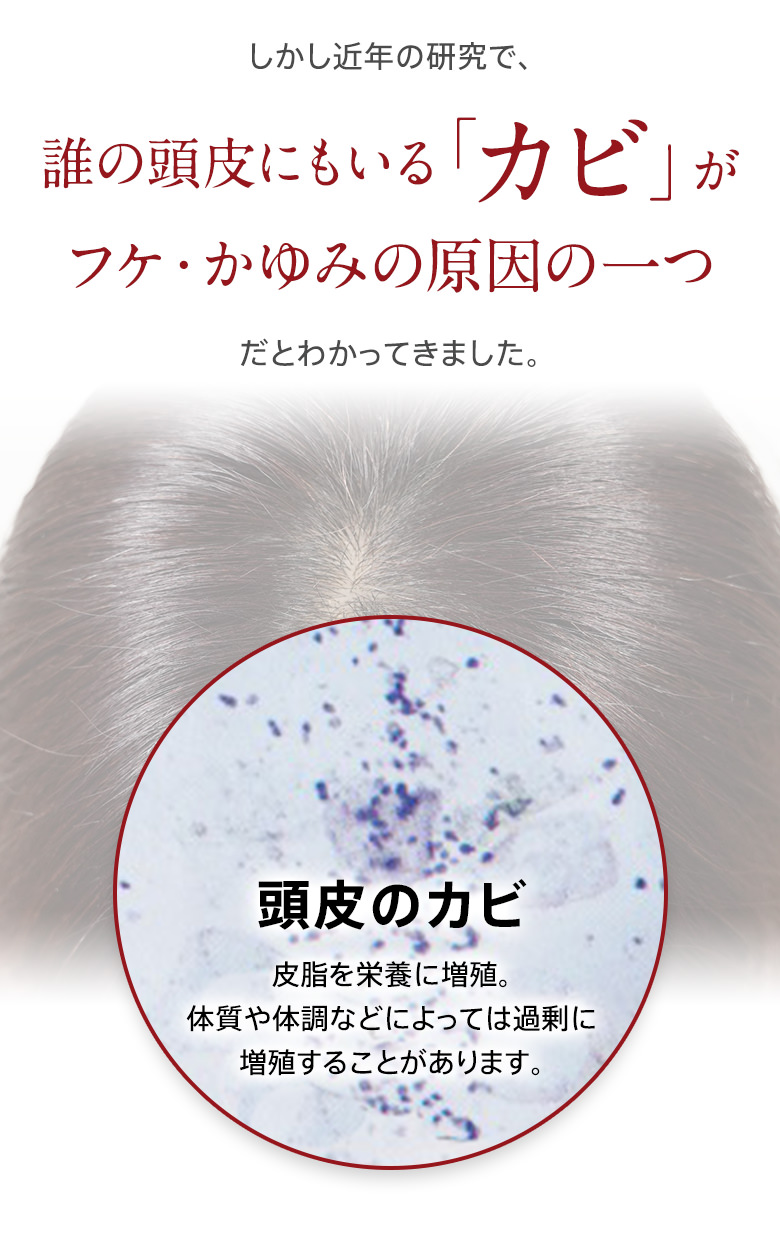 しかし近年の研究で、誰の頭皮にもいる「カビ」がフケ・かゆみの原因の一つだとわかってきました。