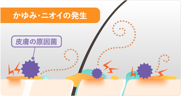 かゆみ・ニオイの発生のイラスト