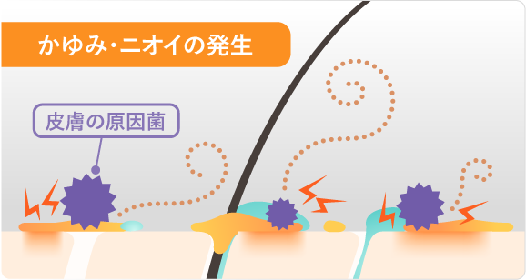 かゆみ・ニオイの発生のイラスト