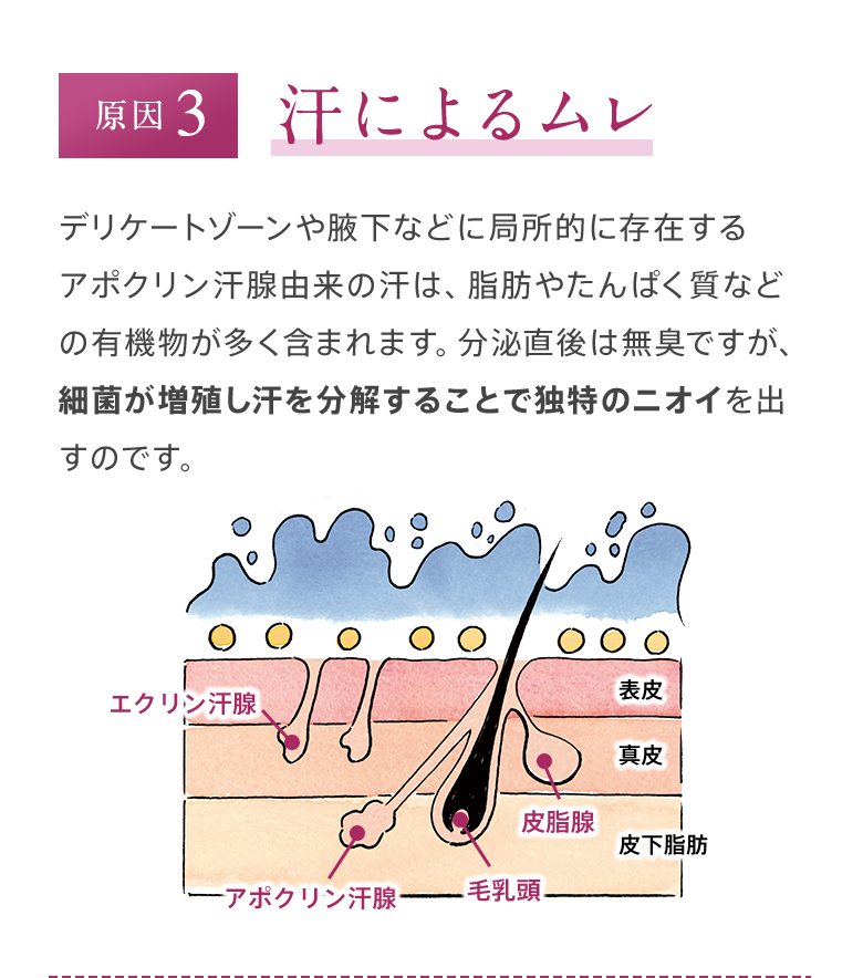 原因3 汗によるムレ デリケートゾーンや腋下などに局所的に存在するアポクリン汗腺由来の汗は、脂肪やたんぱく質などの有機物が多く含まれます。分泌直後は無臭ですが、細菌が増殖し汗を分解することで独特のニオイを出すのです。