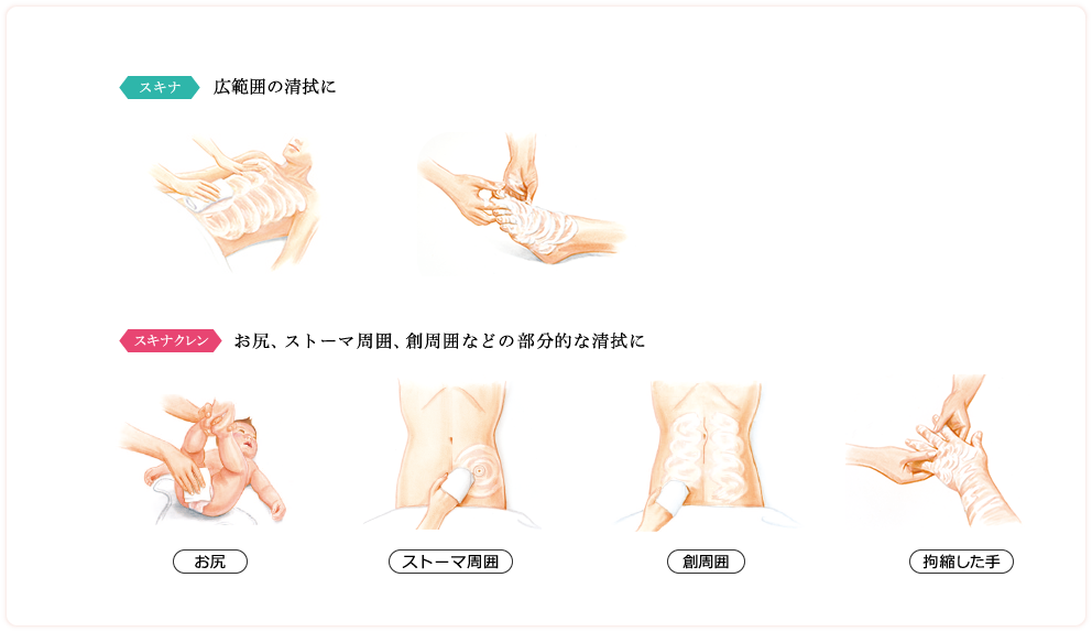 使い方のポイント