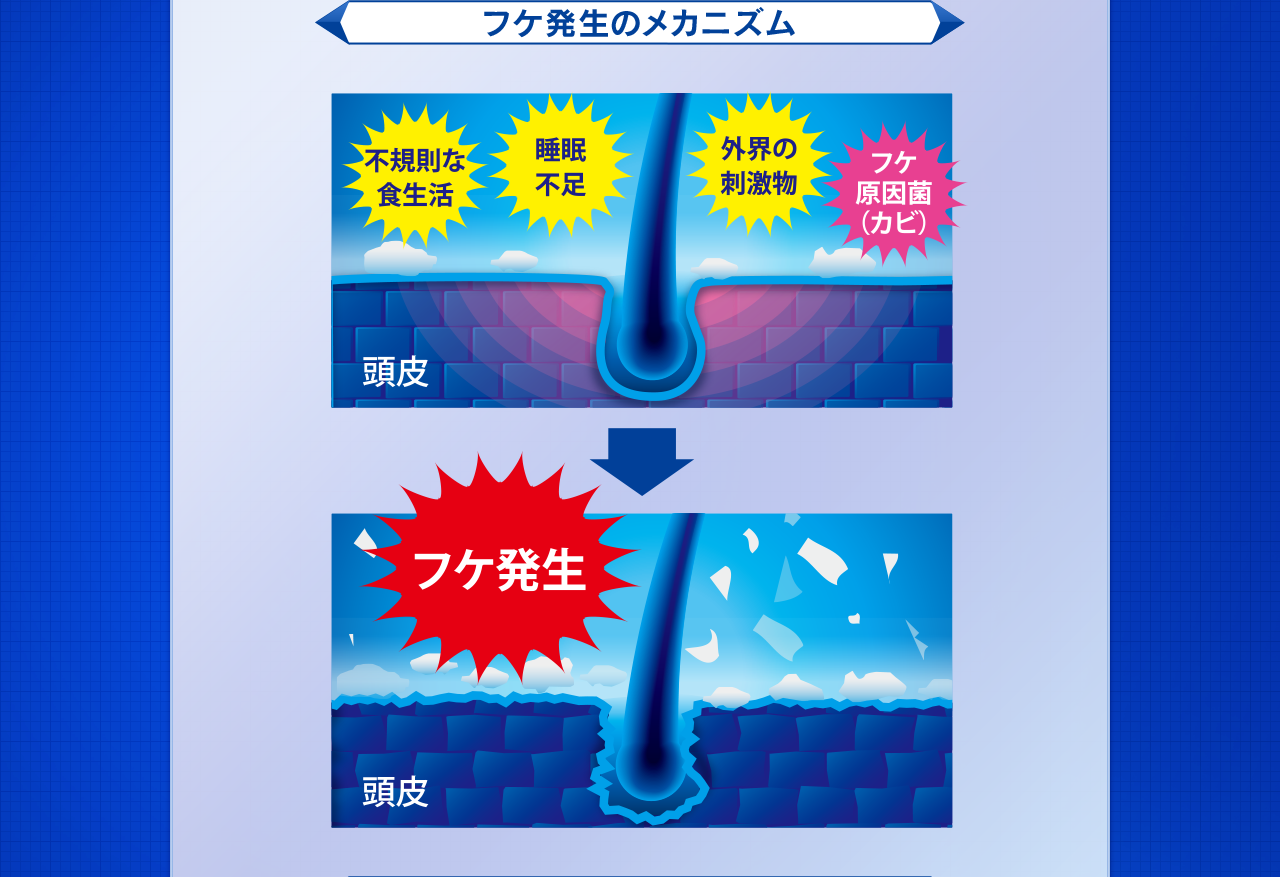 フケ発生のメカニズム