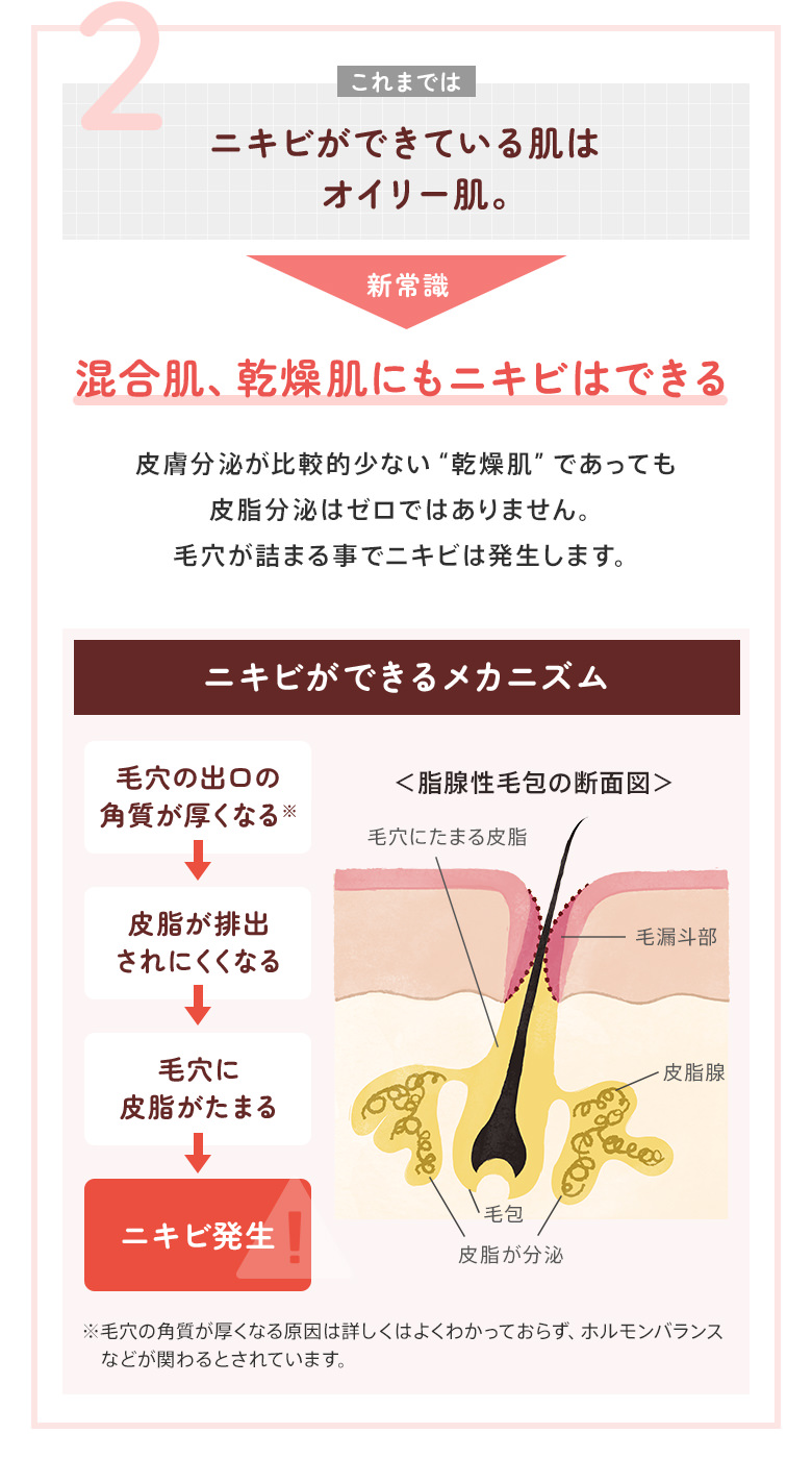 2：ニキビができている肌はオイリー肌。→混合肌、乾燥肌にもニキビはできる