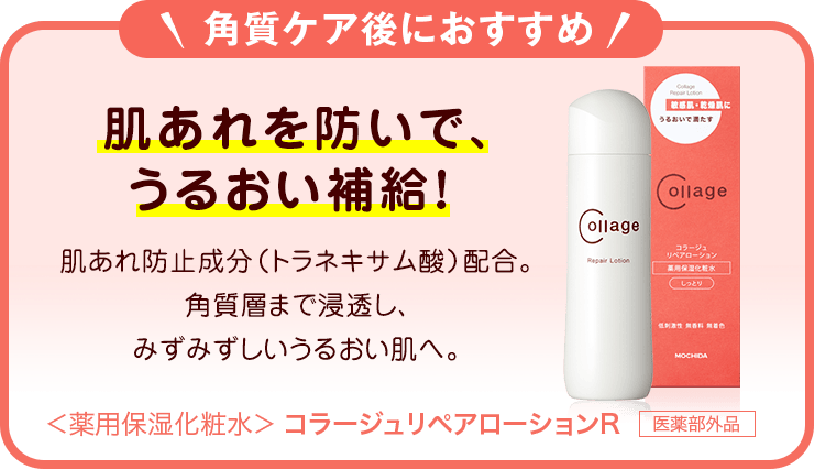 角質ケア後におすすめ 肌あれを防いで、うるおい補給！肌あれ防止成分（トラネキサム酸）配合。角質層まで浸透し、みずみずしいうるおい肌へ。＜薬用保湿化粧水＞コラージュリペアローションR 医薬部外品