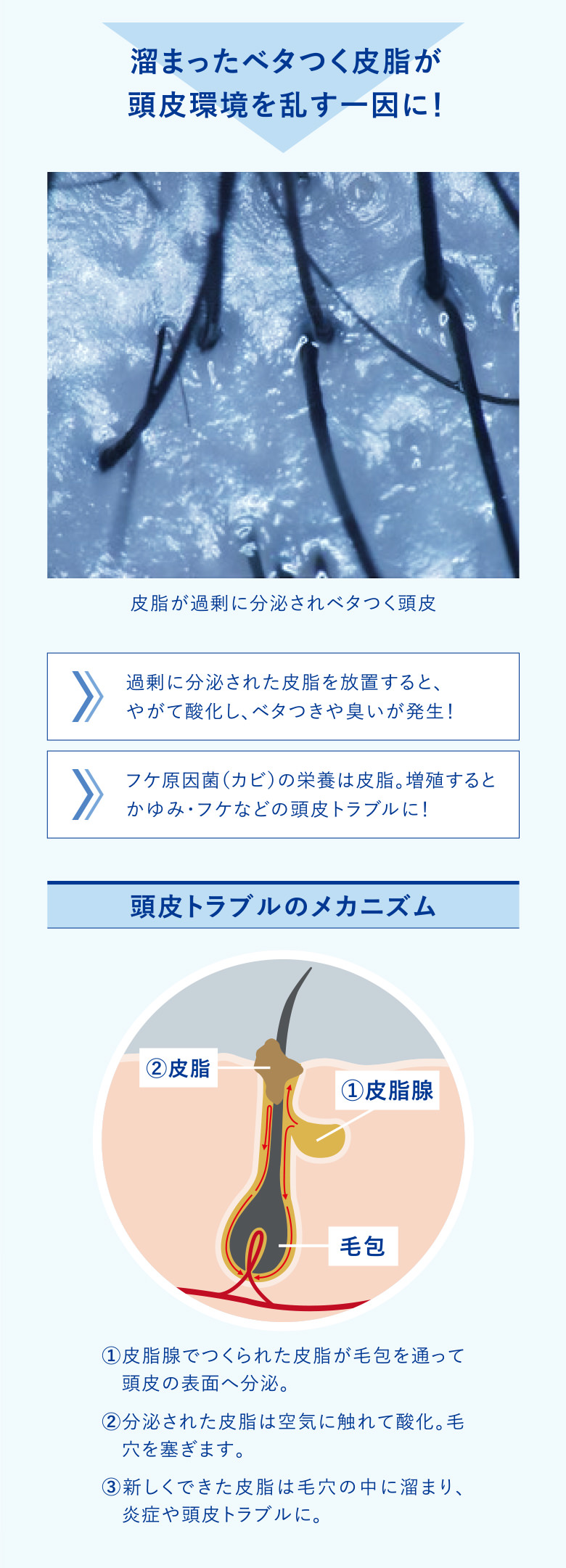 溜まったベタつく皮脂が頭皮環境を乱す一因に！