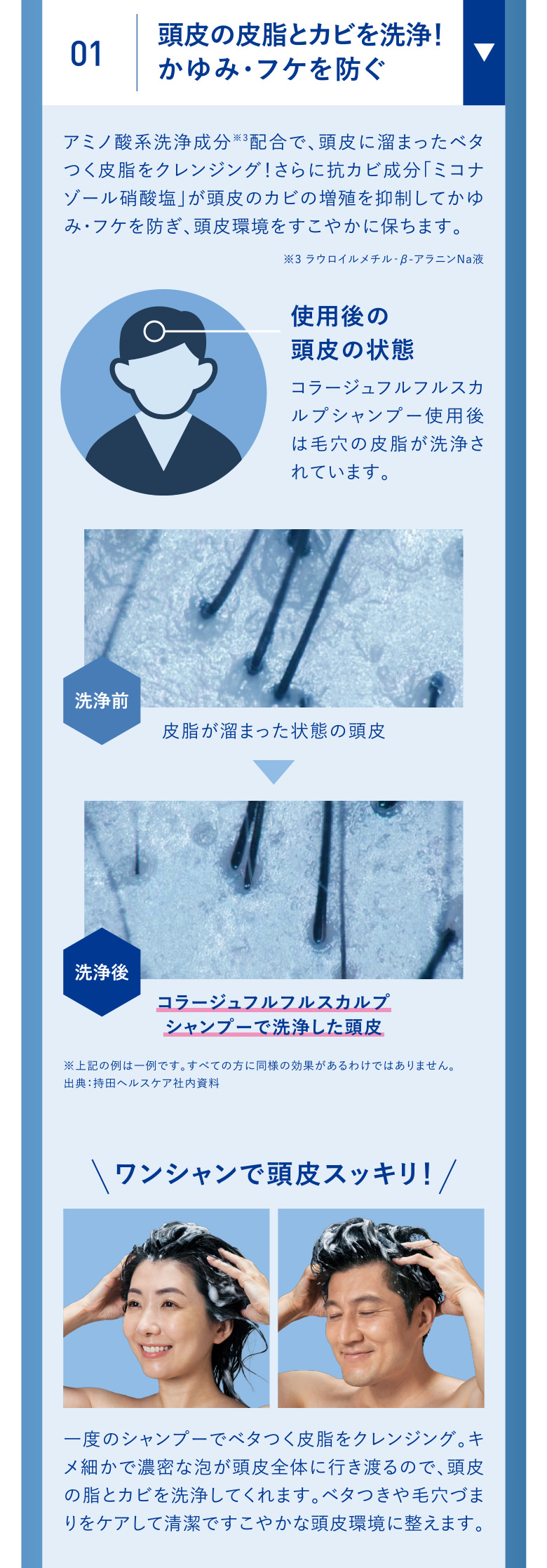 01 頭皮の皮脂とカビを洗浄！かゆみ・フケを防ぐ