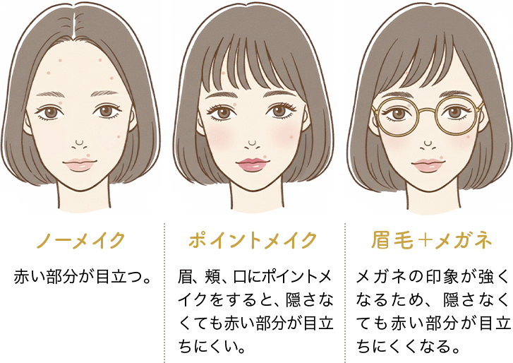 [�m�[���C�N]�Ԃ��������ڗ��B [�|�C���g���C�N]���A�j�A���Ƀ|�C���g���C�N������ƁA�B���Ȃ��Ă��Ԃ��������ڗ����ɂ����B [���с{���K�l]���K�l�̈�ۂ������Ȃ邽�߁A�B���Ȃ��Ă��Ԃ��������ڗ����ɂ����Ȃ�B